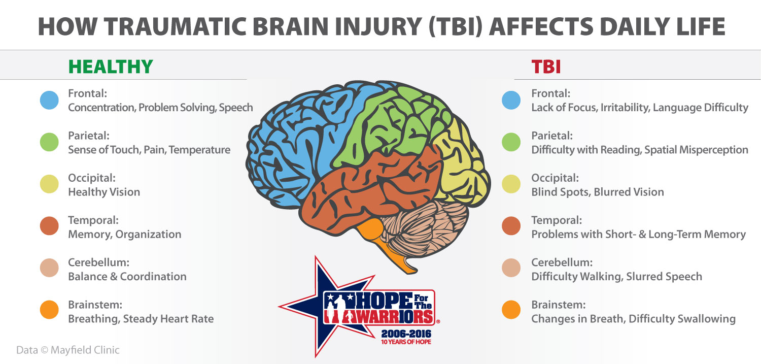What is a Traumatic Brain Injury? 7 Sins Game